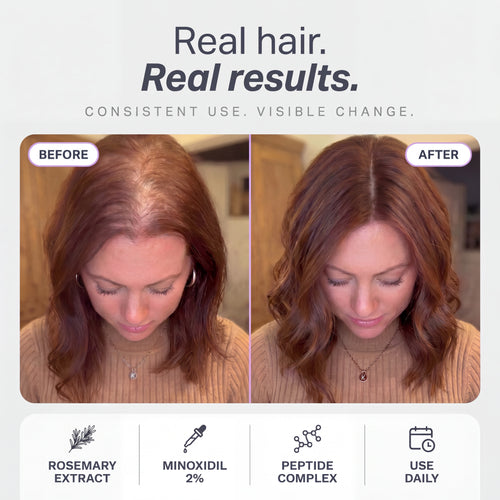 Hair Growth Serum