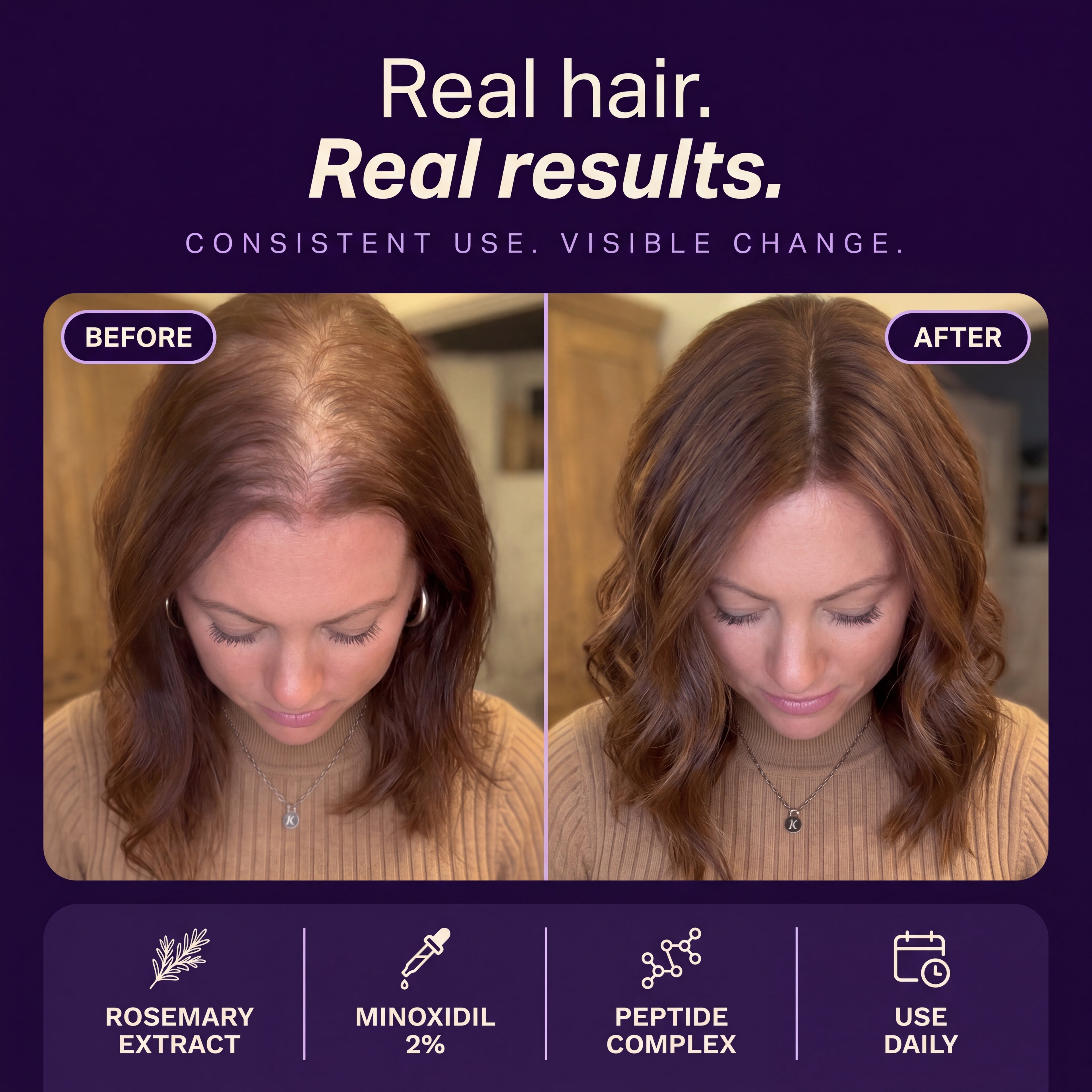 Mamii — Hair Growth Serum