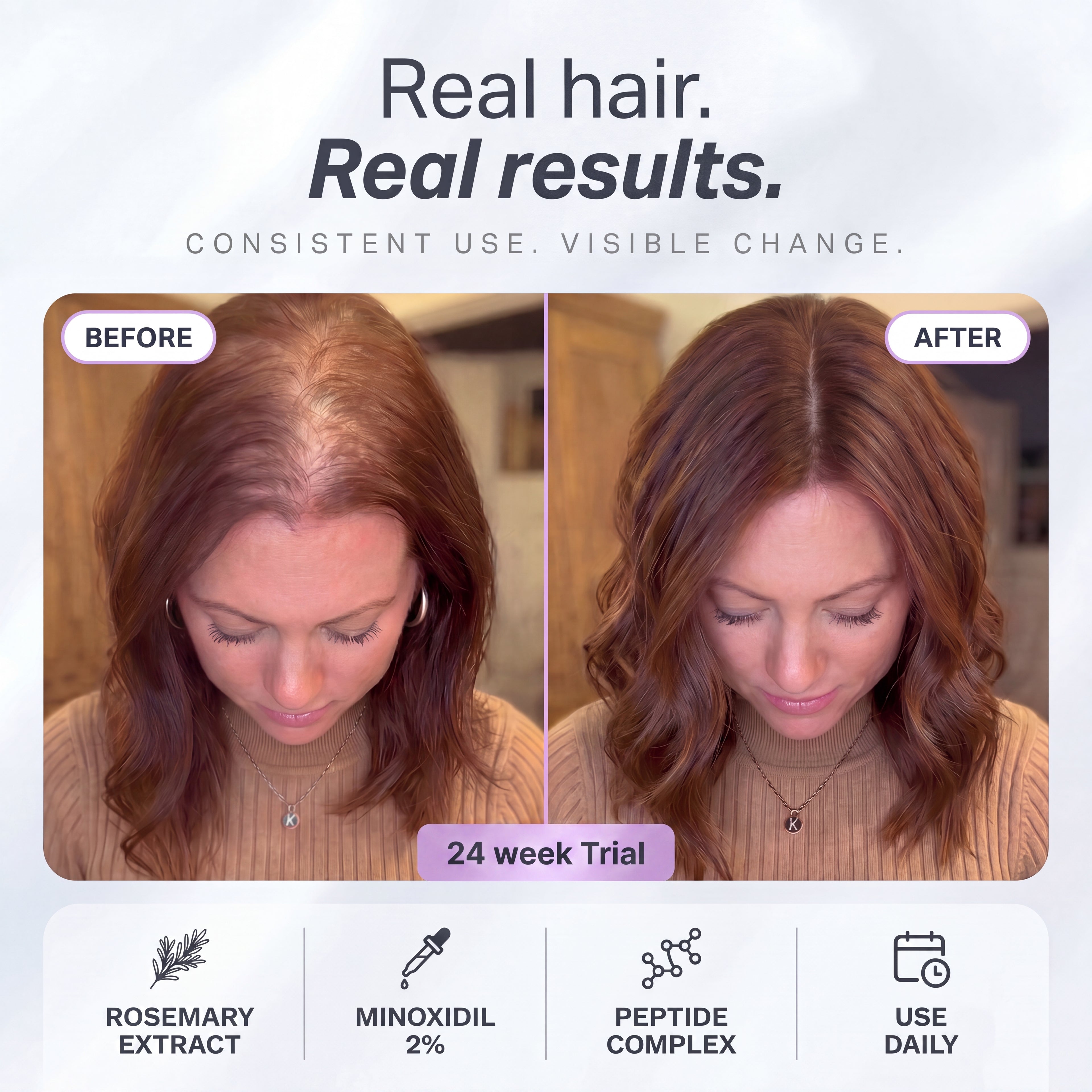 Hair Growth Serum