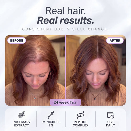Hair Growth Serum